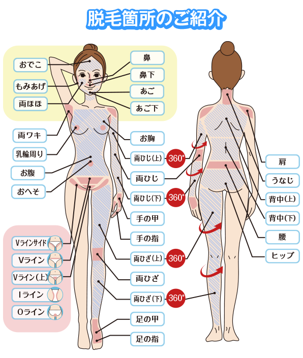 全身脱毛しよ 脱毛１回目 下半身編 キレイモ Kireimo