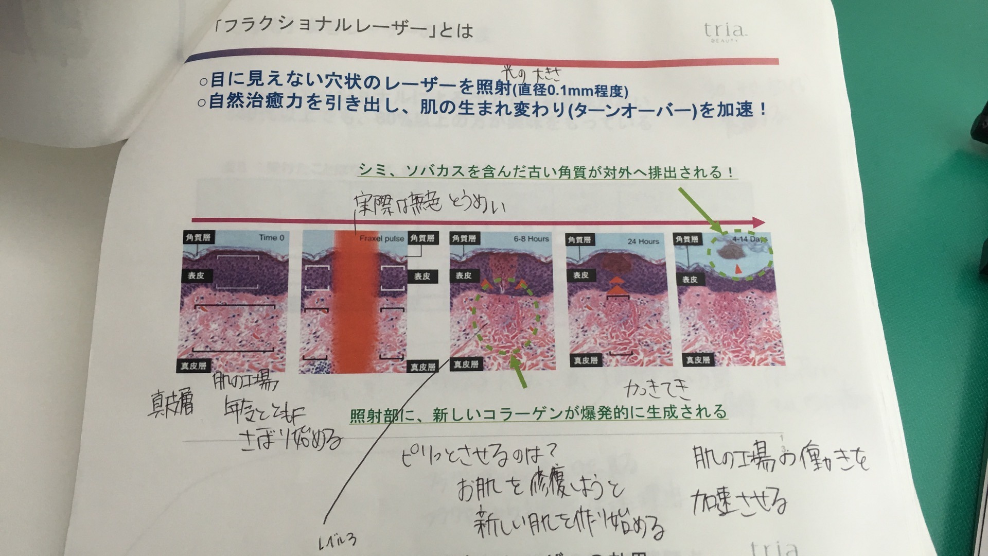 トリアエイジングレーザー美顔器口コミ評価 本当に効果あるの フラクショナルレーザーはお肌に穴をあける