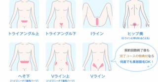 キレイモkireimoのvio脱毛体験談 痛くない脱毛 Vio脱毛とは 1分でわかるvio脱毛