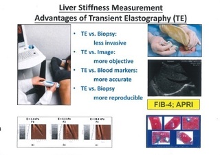 elastography_171117.jpg