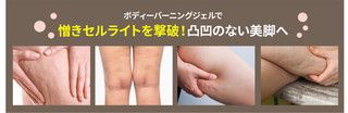 cellulite1.jpg