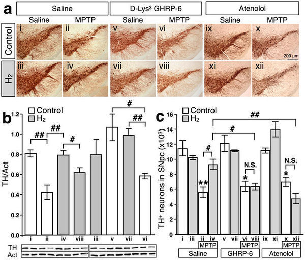 Figure 4    Inhibition of ghrelin secretion or the ghrelin receptor antagonist cancels the neuroprotective effect of oral H2 water---  srep03273-f4.jpg