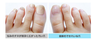 clearnailshot_pc_d1_05.jpg