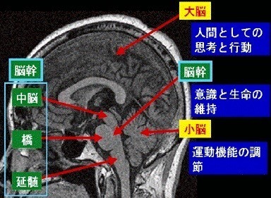 ]fMRI.jpg