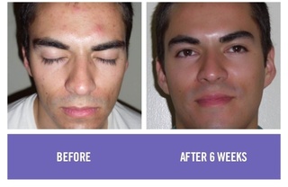 before-and-after-rodan-fields-product-results-41-638.jpg