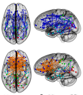 20151121-brain map blog.png