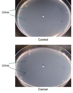 elegans to urea of cancer2.jpg